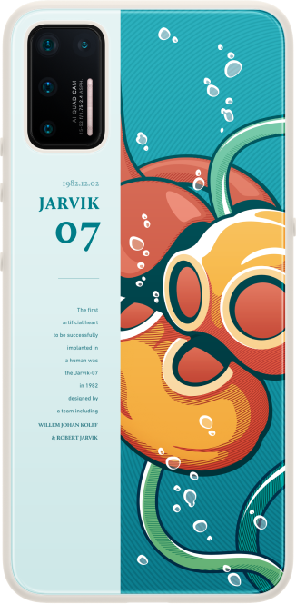 历史上第一宗成功的人工心脏手术